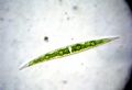 Closterium sp.